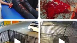 Kejadian Berdarah, Sekelompok Genk Motor Tebas Punggung Remaja 13 Tahun