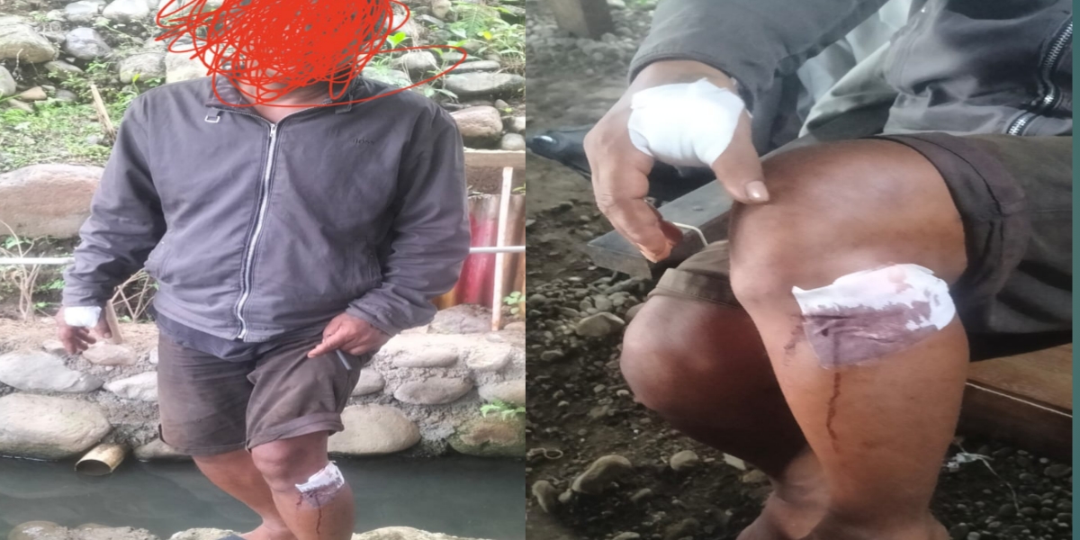 Sukono, korban pemusukan
